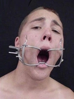 O-ring gag