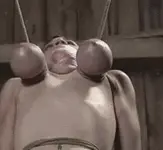 乳房悬挂